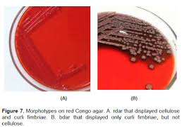 (c) weak black colonies (right sector); African Journal Of Microbiology Research Anti Biofilm Activity Of Ibuprofen And Diclofenac Against Some Biofilm Producing Escherichia Coli And Klebsiella Pneumoniae Uropathogens