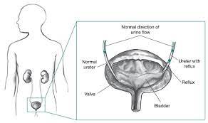 urinary tract in the outline of a male