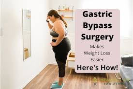 how gastric byp surgery makes weight