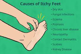 itching of the feet 9 common causes