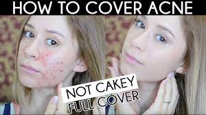 cakey acne coverage foundation routine