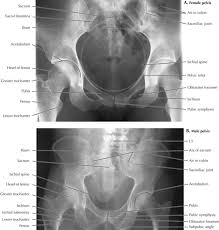 Hemi pelvis anatomy normal ap. Pelvis And Perineum Radiology Key