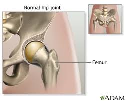 hip joint replacement information