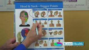 Trigger Point Chart Color Coded Research Based Treatment