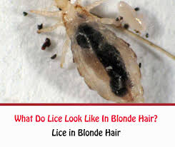 It looks great on graying hair as well as on any dark natural shades. Lice In Blonde Hair What Do Lice Look Like In Blonde Hair Getridofallthings Com