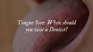 tongue sore when should you visit a