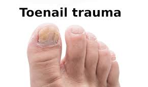 toenail trauma causes and treatment