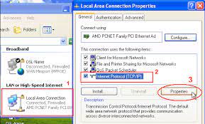configure windows xp ip settings