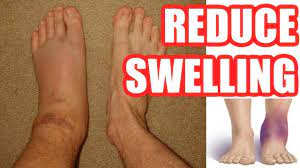 how to reduce swelling make your