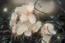 dust mites and dust how to remedy and