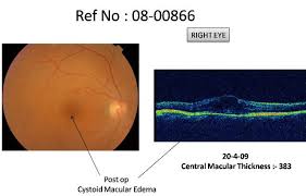 drushti eye and retina center