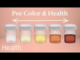 your urine color says about your health