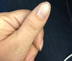 the dangers of the gel manicure a