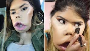 this beauty vlogger with tumour