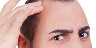 age hair loss causes treatments