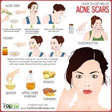 treatments for acne red marks