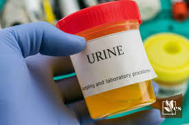 does human urine kill gr