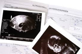 Wäre bereits 7 ssw aber auf ultraschall nicht viel zu sehen. Ssw 7 Die Siebte Schwangerschaftswoche Match Patch