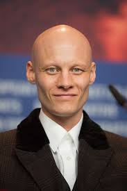 Alopecia areata is a form of alopecia (hair loss). Alopecia Universalis Wikipedia