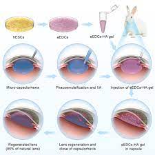 lens regeneration in situ using hescs