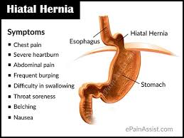 Diet For Hiatal Hernia Foods To Include Foods To Avoid