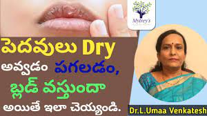 dry lips remes how to get rid of