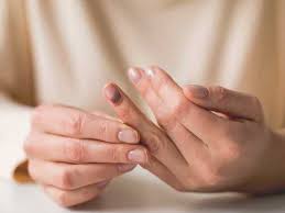 nail bed injury types causes and