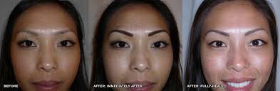 fully healed permanent makeup