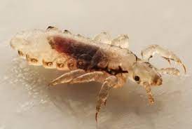 human lice pest information