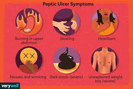 how peptic ulcer disease is diagnosed