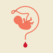 is cord blood banking worth it the
