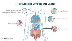 Information is a powerful weapon against uncertainty and fear, and you can use this to your advantage. Asbestos Cancer Mesothelioma Lung Cancer Other Cancers