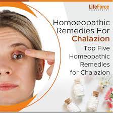 eopathic remes for chalazion