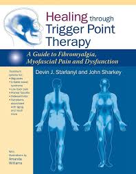 30 New Fibromyalgia Tender Points Chart Pdf Trigger Point