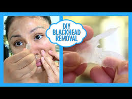 diy blackhead removal diy biore pore