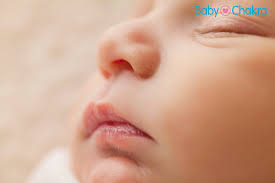 newborn lip blisters causes and