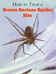 treat a brown recluse spider bite