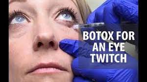 botox for a twitch dr derm you