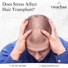 does stress affect transplanted hair