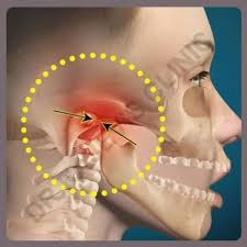 homeopathic treatment for tmj disorders