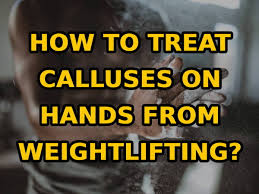 how to treat calluses on hands from
