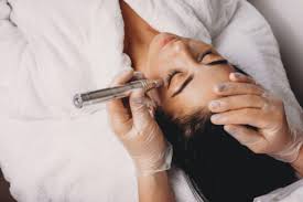 is microdermabrasion the right