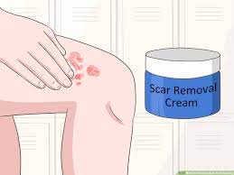 how to prevent a burn from scarring 13