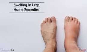 swelling of legs tips advice from top