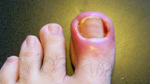 toenail problems causes symptoms and