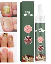 toenail fungus treatment best nail