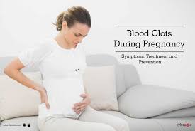 blood clots during pregnancy symptoms