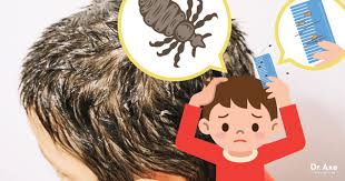 get rid of lice