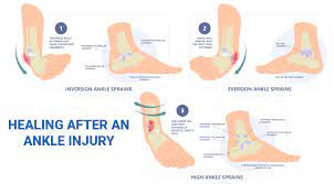ankle injury using sprain ankle treatment