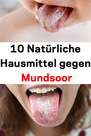 See full list on cdc.gov 10 Naturliche Hausmittel Gegen Mundsoor Natural Remedies Remedies Hand Soap Bottle